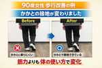 【90歳女性｜歩行改善の一例】